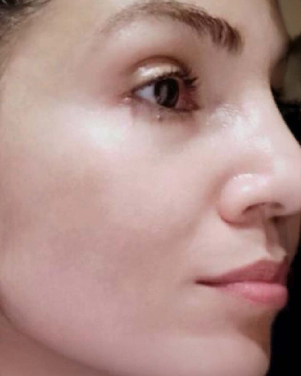 image comparison after